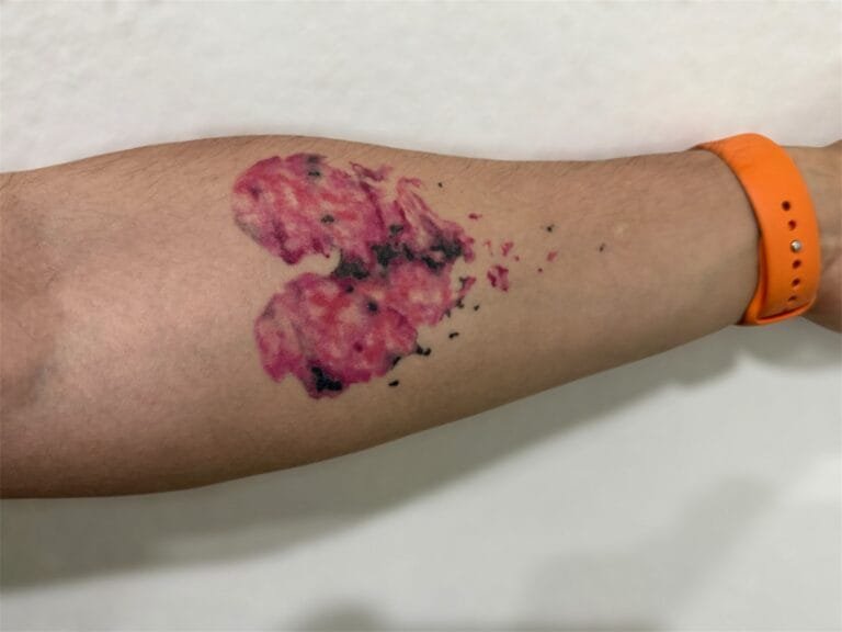 tatuadores