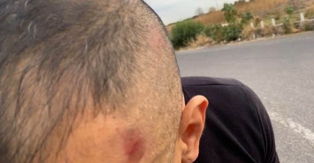 Agentes de Investigación de la Fiscalía de Guanajuato agreden a integrante de portal digital en Juventino Rosas